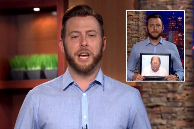 My Choice Hair Hair Replacement for Men Alex 4