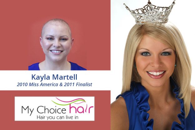 My Choice Hair Hair Replacement for Women Kayla 3