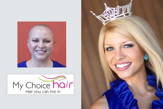 My Choice Hair Hair Replacement for Women Kayla 2